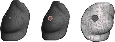 Soft-tissue simulation of the breast for intraoperative navigation and fusion of preoperative planning